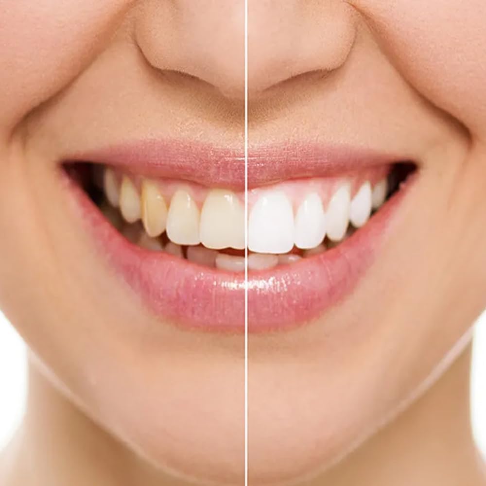 Denivit Dentifricio Sbiancante Smokers Anti Macchia Extra Fresco 50ml