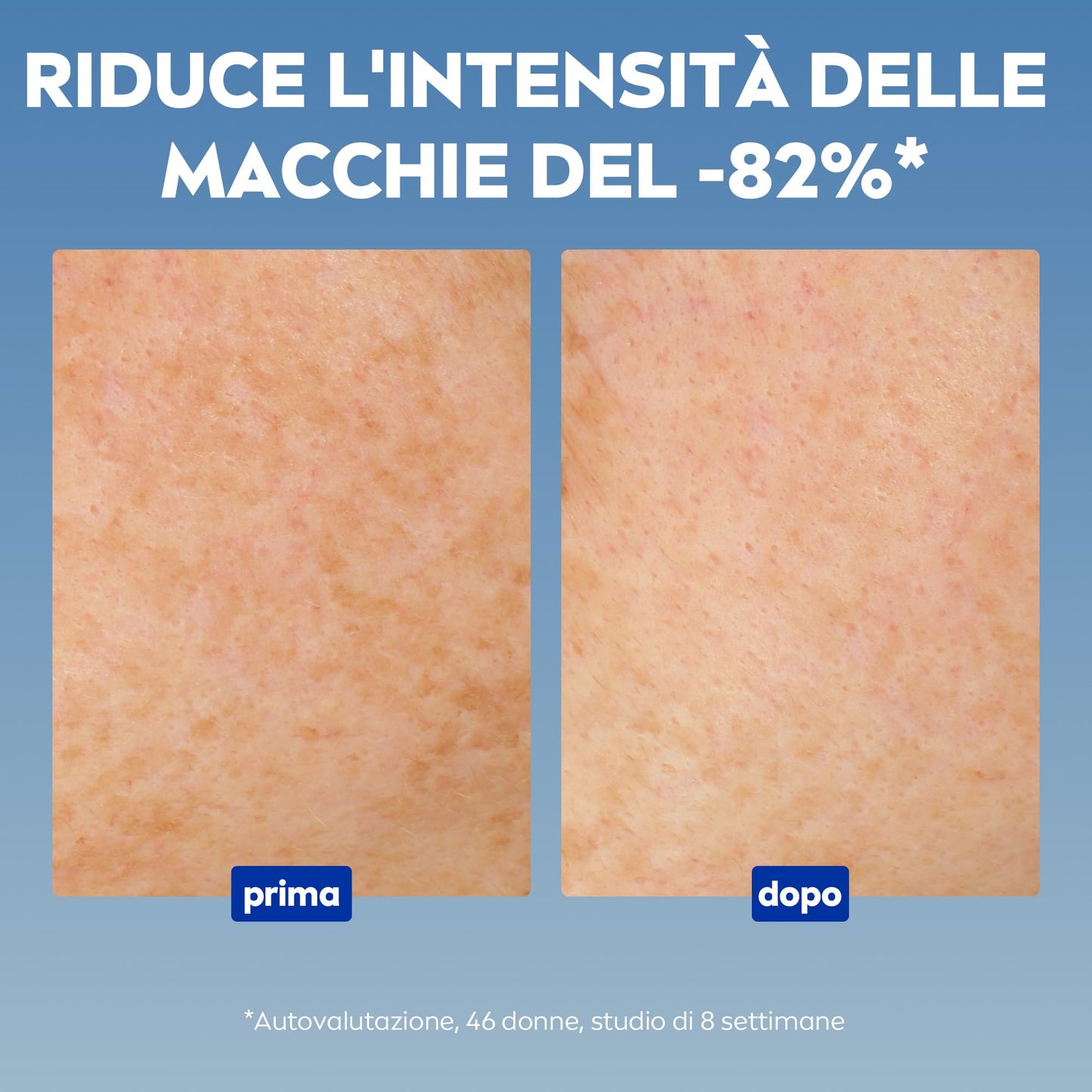 NIVEA Luminous630 Siero Viso Anti-Macchie Trattamento Avanzato 30 ml, Siero antimacchia viso per una pelle luminosa, Siero viso Acido Ialuronico e Thiamidol brevettato per tutti i tipi di macchie