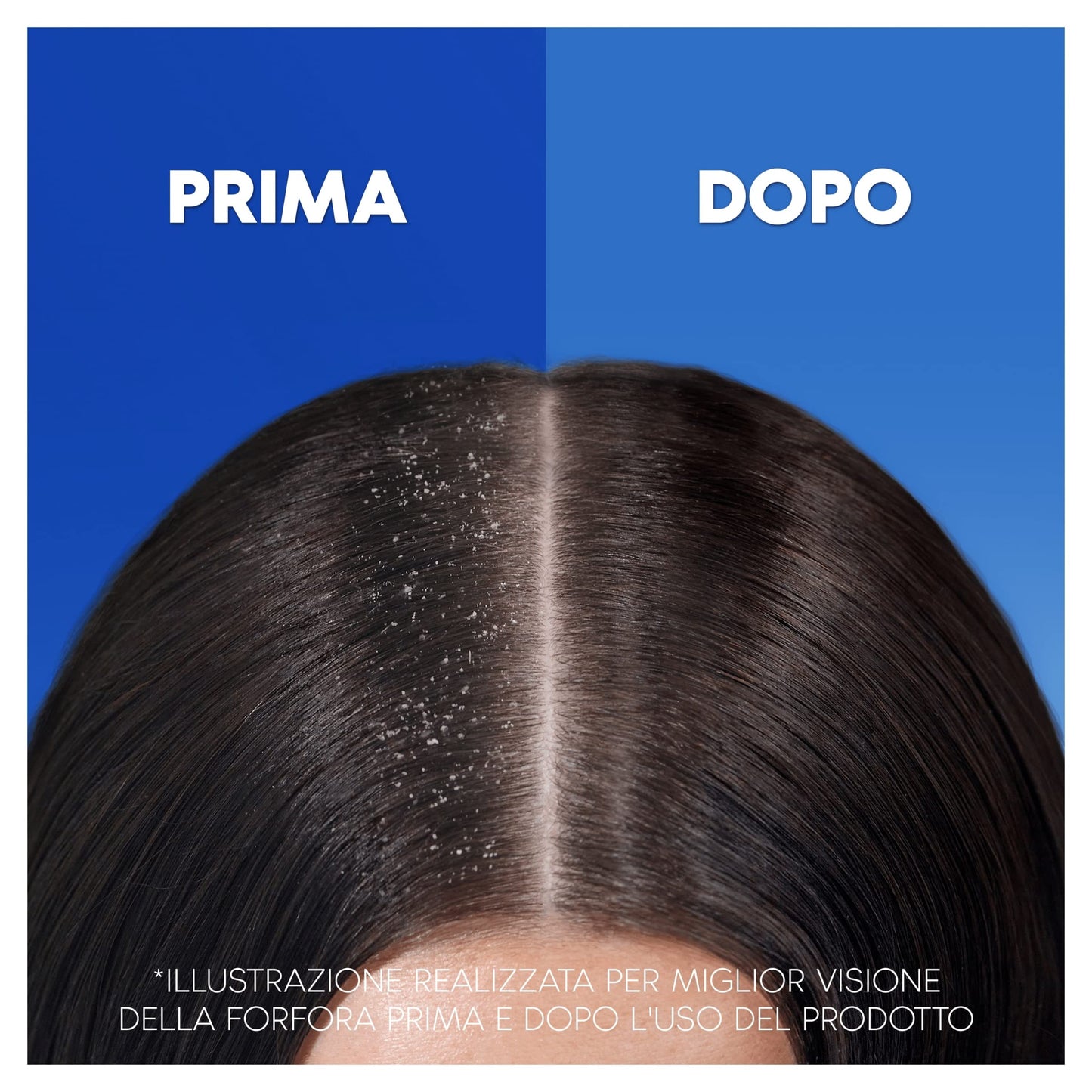 Head & Shoulders Antiforfora Shampoo e Balsamo 2in1, Anticaduta Dovuta A Rottura, Fino Protezione dalla Forfora per Cute e Capelli, Con Microbioma Bilanciato, 225 ml x6