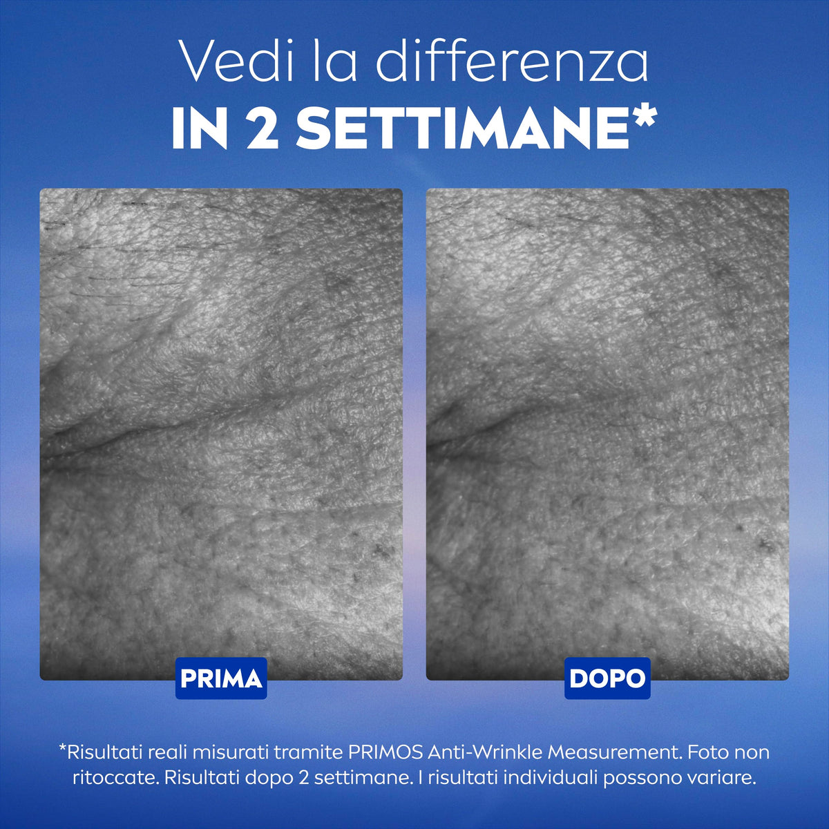 NIVEA Cellular Epigenetics Siero Ringiovanente 30 ml, Siero viso antirughe che riduce i segni dell'età in 2 settimane, Face serum con Acido Ialuronico ed Epicelline, Skincare per tutti i tipi di pelle