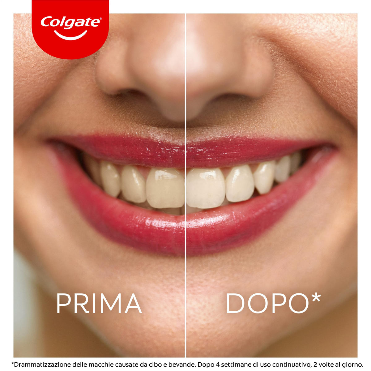 Colgate Penna Sbiancante Denti Notturna Max White Overnight, Sbiancamento Denti, Sicuro per lo Smalto 2,5ml I Riduce le macchie superficiali I