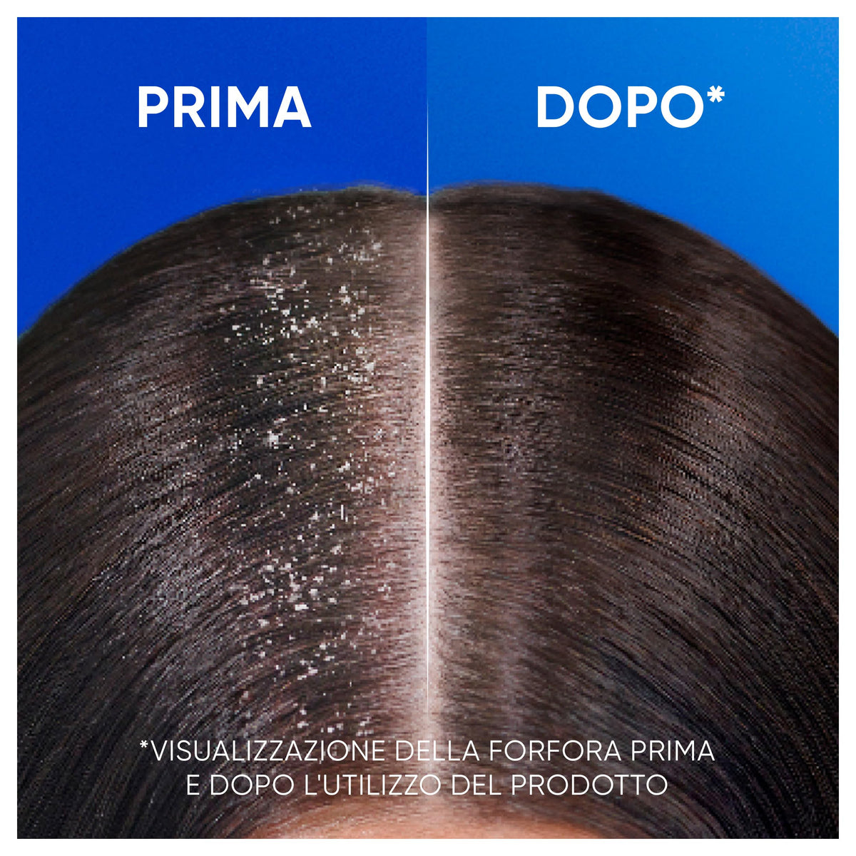 Head & Shoulders Apple Fresh Shampoo Antiforfora 250ml Formato Convenienza X6. Uso Quotidiano. Fino al 100% Protezione dalla Forfora, Clinicamente Testato. Per Tutti i Tipi di Cute e Capelli
